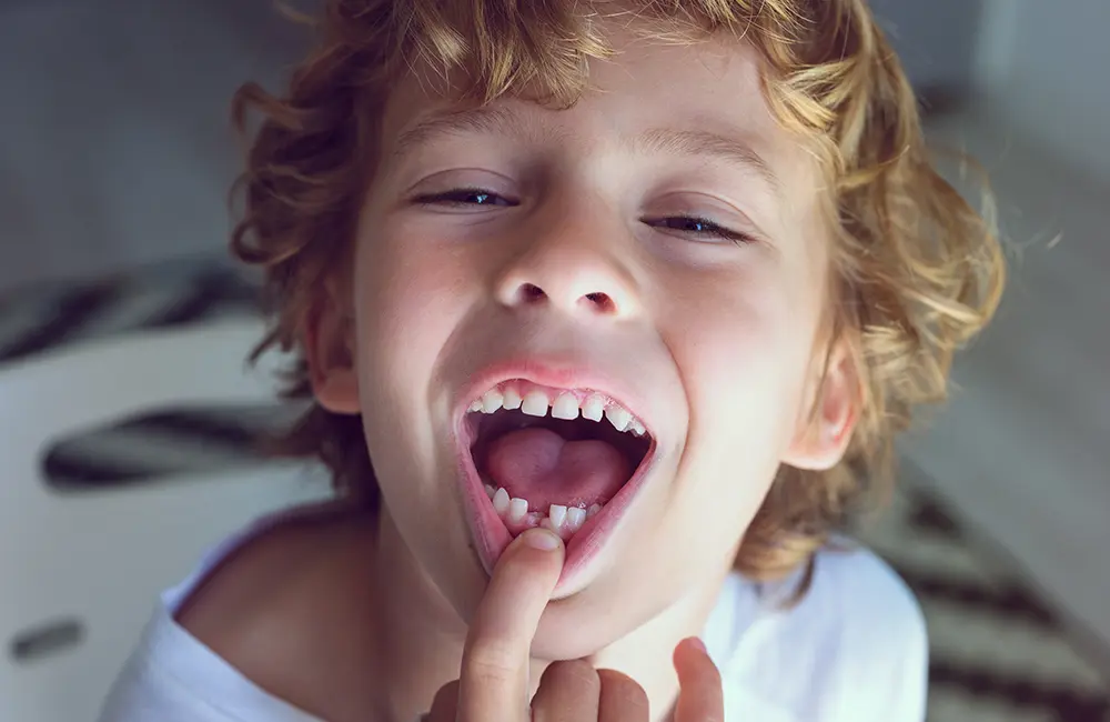 Criança com trauma dentário a precisar de endodontia